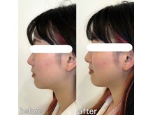 整え屋 レッド(RED)/阿波座/本町/小顔矯正/美容整体