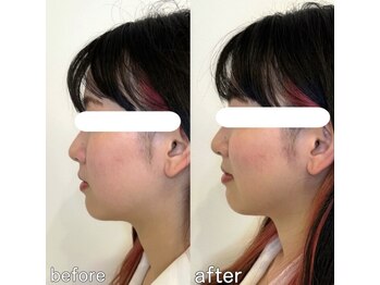 整え屋 レッド(RED)/阿波座/本町/小顔矯正/美容整体