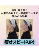 ヨサパーク ナナラーレア 福島店(YOSA PARK nanala lea)/痩身/ダイエット/リンパ/産後