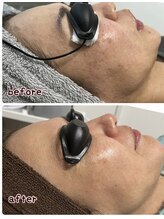 ケースタイル(k.style)/フォトWax before after