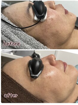 ケースタイル(k.style)/フォトWax before after