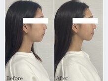 リタ(Rita.)/横顔も変わる！！