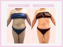 スリムライン 山形店(The Slim Line)/before→after