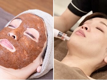 マリスレジーナ 新保店(MarisRegina)の写真/毛穴レス肌♪黒ずみ・角栓除去【幹細胞ハーブピーリング+毛穴洗浄★￥6600】圧倒的な変化に感動!剥離なし◎