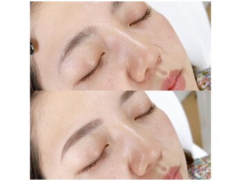 ホワイトアイ 芦屋(WHITE EYE)