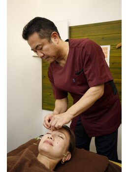 とまり木鍼灸整骨院 北青山院/院代表の美容鍼施術