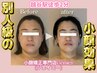 【圧倒的人気No. 1】頭から首肩デコルテまで華奢に本格矯正(所要時間90分)