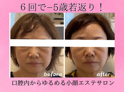 ラヴィスマイル(laviesmile)の写真