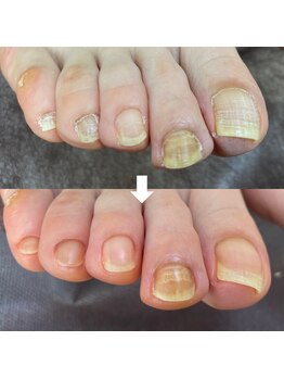 ビビィ(vivie)/一度の施術でこんなに見違えます