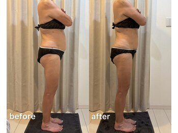 レミュービューティー(Remieux beauty)/before/after