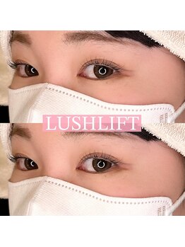 リンド エステ まつげ 京成大久保(Lind)/ラッシュリフト