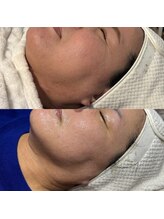 ミヨン(Miyong)/1年の継続の大事さ