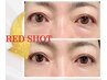 【目元のたるみ改善★クマ・むくみ速攻ケア!】戻らない脂肪分解!RED SHOT導入