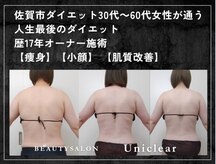 ユニクリア 佐賀(Uniclear)