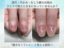 ブルームーンネイルズ(BLOOMOON.nails)