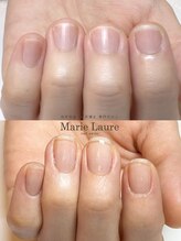 マリーロール 梅田店(Marie Laure)/自爪育成/深爪矯正/ネイルケア