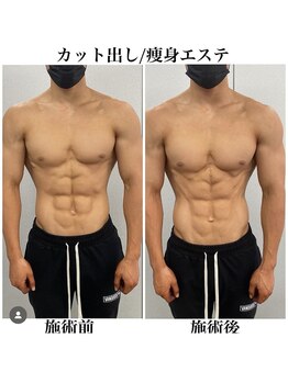 ヴィーナス(Venus)/スタッフ施術/上半身カット出し