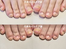 ニコプラス(NICO+)/フット爪育ネイルケア