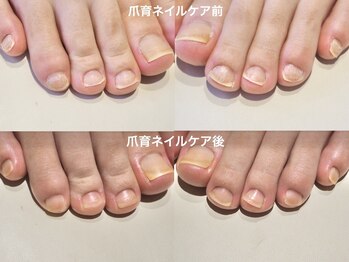 ニコプラス(NICO+)/フット爪育ネイルケア