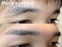 アミュゼ(Amuser)/男性眉脱毛