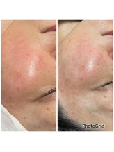 ルクール(Le Couer)/光フォト