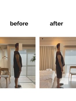 フィデル(fidele)/ストレートネック、臀部痛