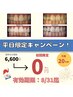 【残り10名樣限定★】平日美白ホワイトニング15分×2（30分照射）お試し¥0！