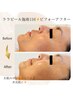 【全身メンテ】骨盤調整＋背面リンパ＋顔・首ララピール＋頭筋ヘッド　120分