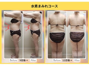 ヨサパーク ミミ 高野店(YOSA PARK mimi)