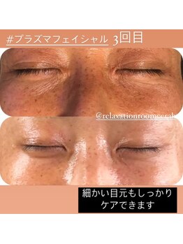 リラクゼーションルーム チュラ(Relaxation Room CERAH)/