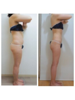 デイスパ ヴィータ/before after