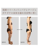 ソルヴィス 根本(soLvis)/ガチガチ身体をほぐして整える