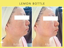 ハノハノ 八代店(HANO HANO)/【八代初導入！】レモンボトル☆