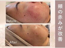 エヴァル(ewalu)/ー ３ヶ月の変化 ー