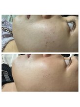 美プラス(美Plus)/小顔矯正×肌質改善