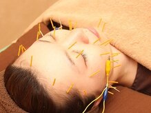 さくら鍼灸整骨院の雰囲気（美容鍼/小顔矯正などハイクオリティな美容特化メニューもご用意!）