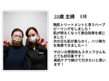 サロン ド ヒノキ(Salon de HINOKI)/ハーブピーリングお客様の声