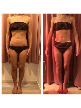 マルロ美容整体院 バイ サロンリーナ(MARLO美容整体院 by Salon Lena)/A様体脂肪17%とアスリート並に