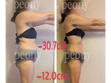 ピオニー(PEONY)/【痩身】全身徹底美ボディメイク