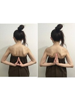 池袋東口整体院/【ビフォーアフター6】肩甲骨