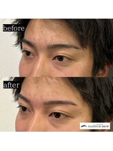 プラチナムブロウ 新潟(PLATINUM BROW)/美眉スタイリングのお客様（20代