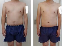 ユニクリア(Uni clear)/メンズ痩身エステ