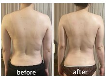 リムアール(Limh R)/ブライダル