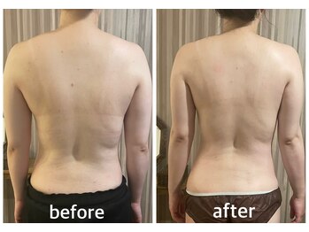 リムアール(Limh R)/ブライダル