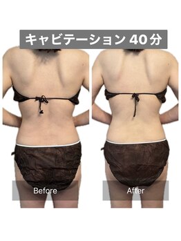 アネモネ/ダイエット/痩身/腸活/耳つぼ