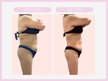 スリムライン 山形店(The Slim Line)/before→after