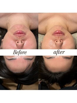 マヌレニ(manuleni)/みんながなりたい小顔に近づく