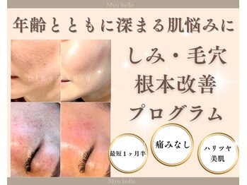 ミュベル(Myubelle)