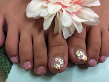 リングアリング(Ring a Ring)/キッズネイル