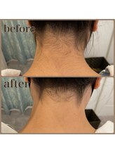 ファビー(Fabby)/シェービング(襟剃り)